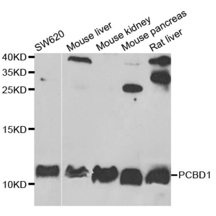 Western blot - PCBD1 antibody from Signalway Antibody (38872) - Antibodies.com