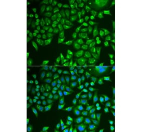 Immunofluorescence - PNLIP antibody from Signalway Antibody (38876) - Antibodies.com