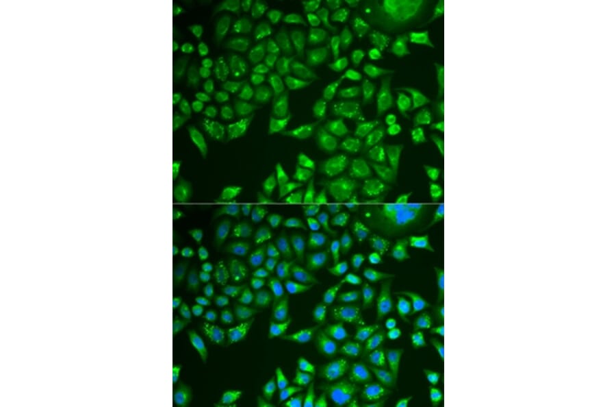 Immunofluorescence - PNLIP antibody from Signalway Antibody (38876) - Antibodies.com
