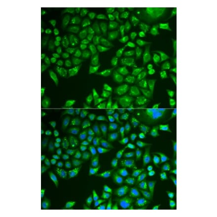 Immunofluorescence - PNLIP antibody from Signalway Antibody (38876) - Antibodies.com
