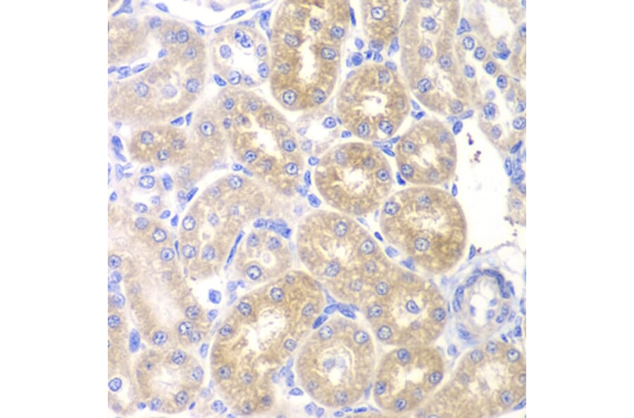 Immunohistochemistry - PNLIP antibody from Signalway Antibody (38876) - Antibodies.com