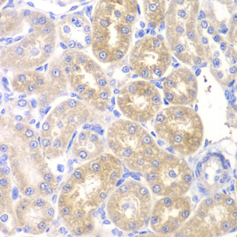 Immunohistochemistry - PNLIP antibody from Signalway Antibody (38876) - Antibodies.com