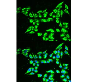 Immunofluorescence - KLK10 antibody from Signalway Antibody (38878) - Antibodies.com