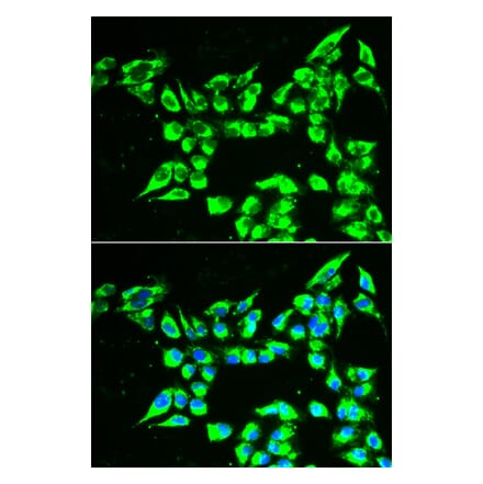 Immunofluorescence - KLK10 antibody from Signalway Antibody (38878) - Antibodies.com