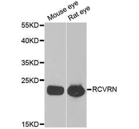 Western blot - RCVRN antibody from Signalway Antibody (38883) - Antibodies.com