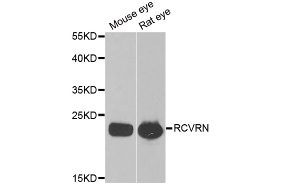 Western blot - RCVRN antibody from Signalway Antibody (38883) - Antibodies.com