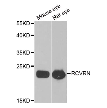 Western blot - RCVRN antibody from Signalway Antibody (38883) - Antibodies.com