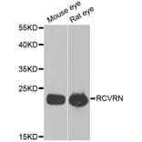 Western blot - RCVRN antibody from Signalway Antibody (38883) - Antibodies.com