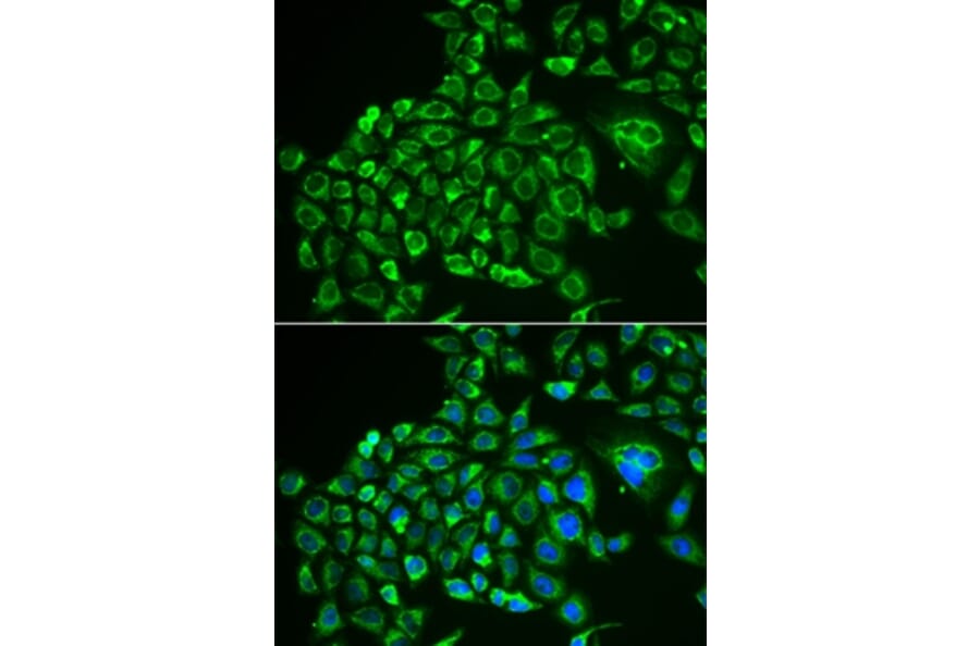 Immunofluorescence - RCVRN antibody from Signalway Antibody (38883) - Antibodies.com