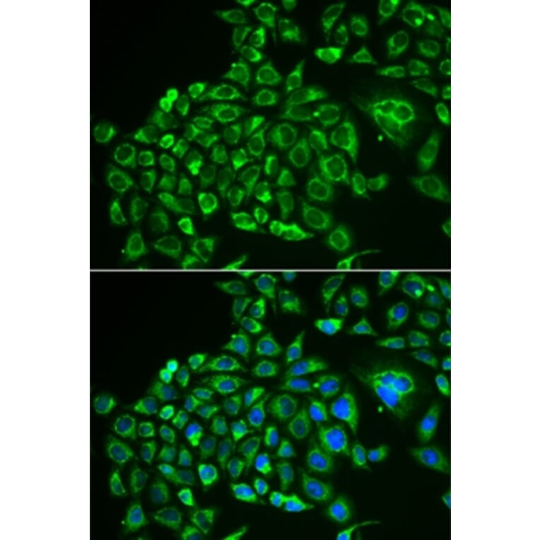 Immunofluorescence - RCVRN antibody from Signalway Antibody (38883) - Antibodies.com