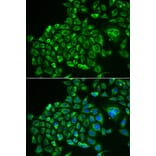 Immunofluorescence - RCVRN antibody from Signalway Antibody (38883) - Antibodies.com