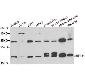 Western blot - RPL11 antibody from Signalway Antibody (38886) - Antibodies.com