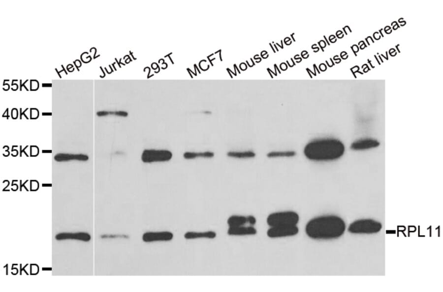 Western blot - RPL11 antibody from Signalway Antibody (38886) - Antibodies.com