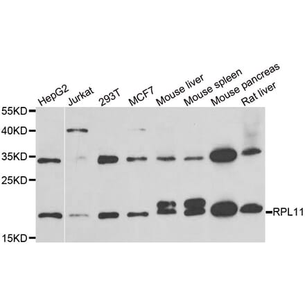 Western blot - RPL11 antibody from Signalway Antibody (38886) - Antibodies.com