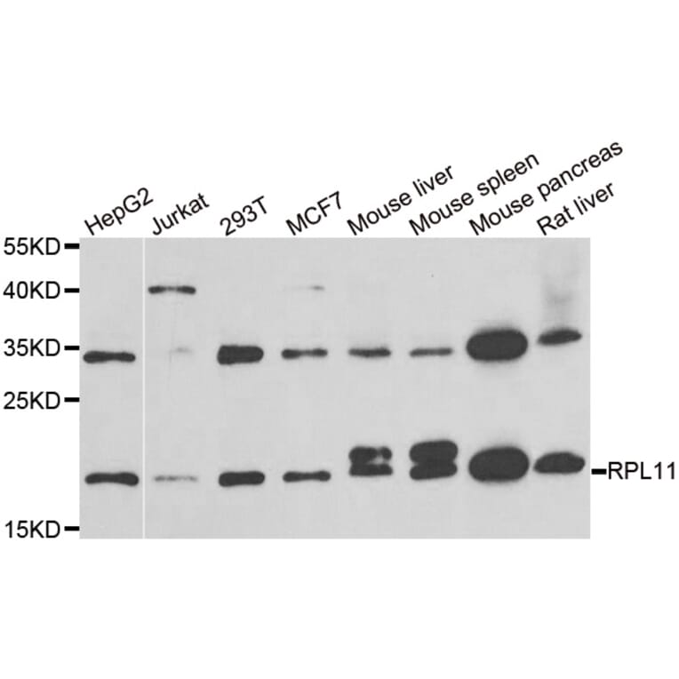 Western blot - RPL11 antibody from Signalway Antibody (38886) - Antibodies.com