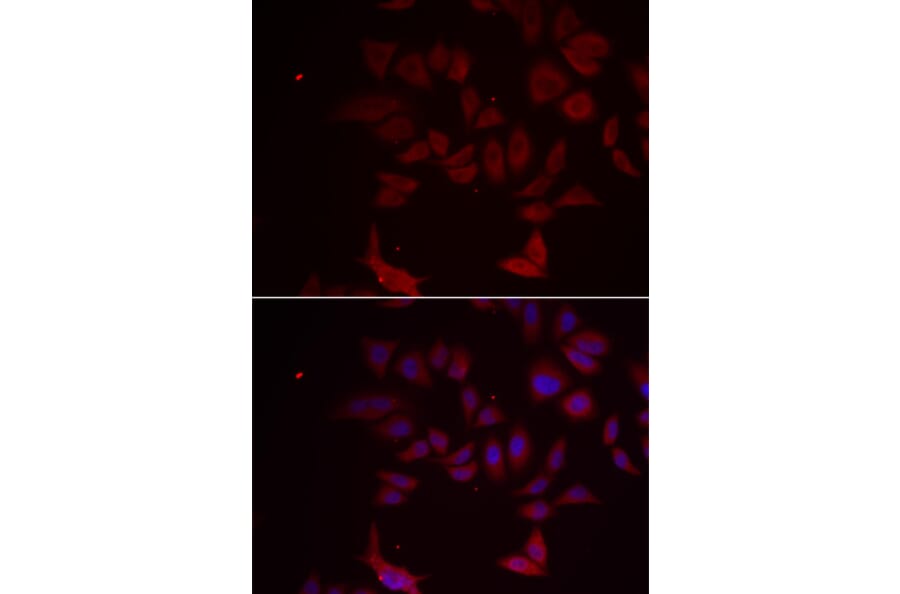 Immunofluorescence - RPL11 antibody from Signalway Antibody (38886) - Antibodies.com