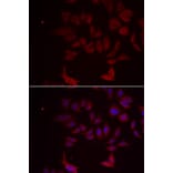Immunofluorescence - RPL11 antibody from Signalway Antibody (38886) - Antibodies.com