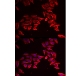 Immunofluorescence - SFRP4 antibody from Signalway Antibody (38888) - Antibodies.com