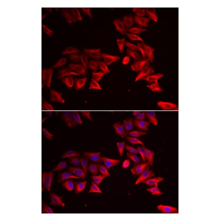 Immunofluorescence - SFRP4 antibody from Signalway Antibody (38888) - Antibodies.com