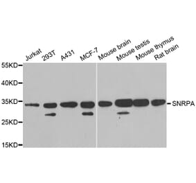 Western blot - SNRPA antibody from Signalway Antibody (38889) - Antibodies.com