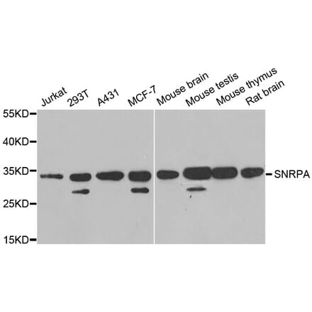 Western blot - SNRPA antibody from Signalway Antibody (38889) - Antibodies.com