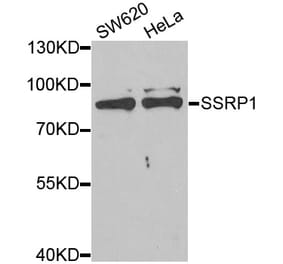 Western blot - SSRP1 antibody from Signalway Antibody (38892) - Antibodies.com