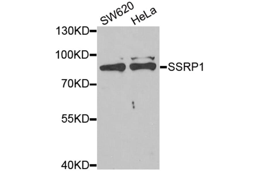 Western blot - SSRP1 antibody from Signalway Antibody (38892) - Antibodies.com