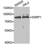 Western blot - SSRP1 antibody from Signalway Antibody (38892) - Antibodies.com