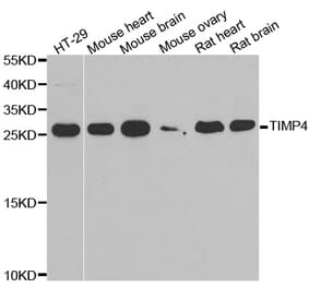 Western blot - TIMP4 antibody from Signalway Antibody (38895) - Antibodies.com