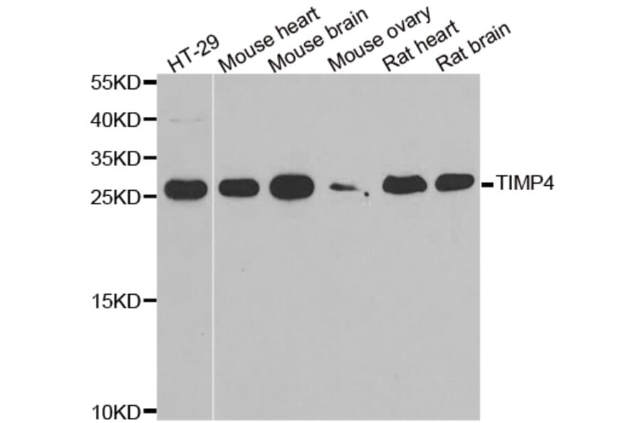Western blot - TIMP4 antibody from Signalway Antibody (38895) - Antibodies.com