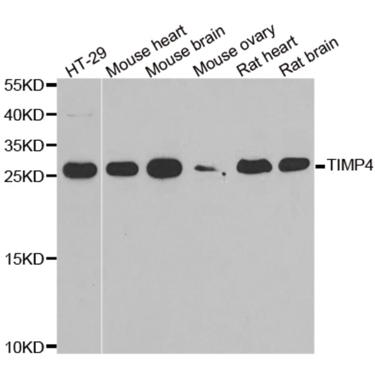 Western blot - TIMP4 antibody from Signalway Antibody (38895) - Antibodies.com