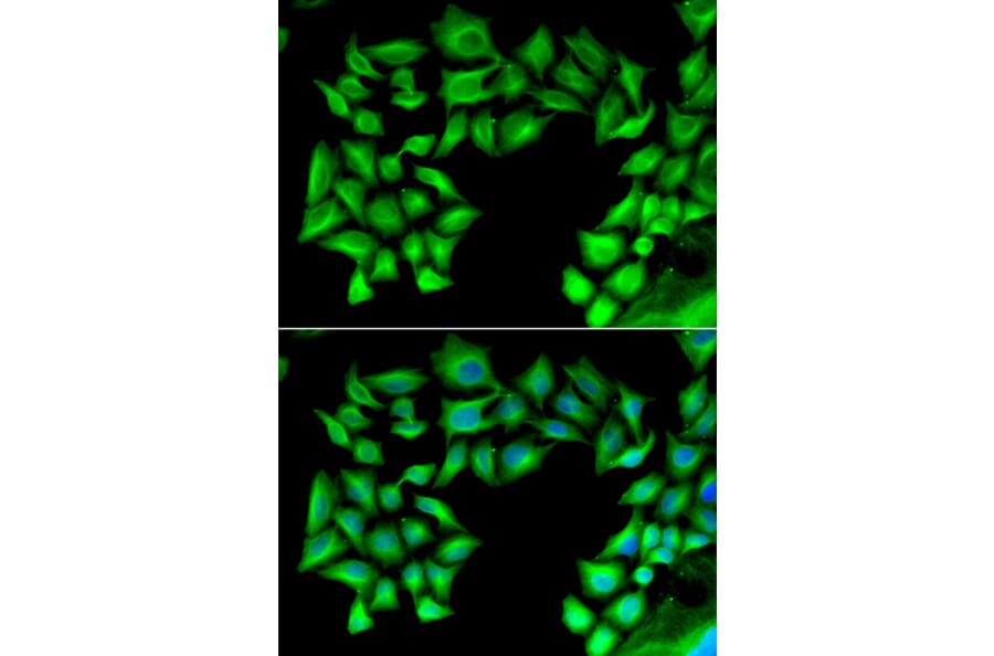 Immunofluorescence - TIMP4 antibody from Signalway Antibody (38895) - Antibodies.com