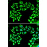 Immunofluorescence - TIMP4 antibody from Signalway Antibody (38895) - Antibodies.com