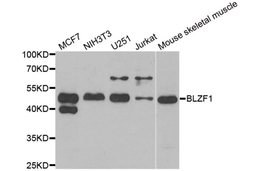 Western blot - BLZF1 antibody from Signalway Antibody (38908) - Antibodies.com