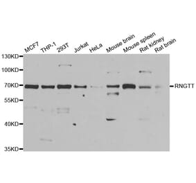 Western blot - RNGTT antibody from Signalway Antibody (38909) - Antibodies.com