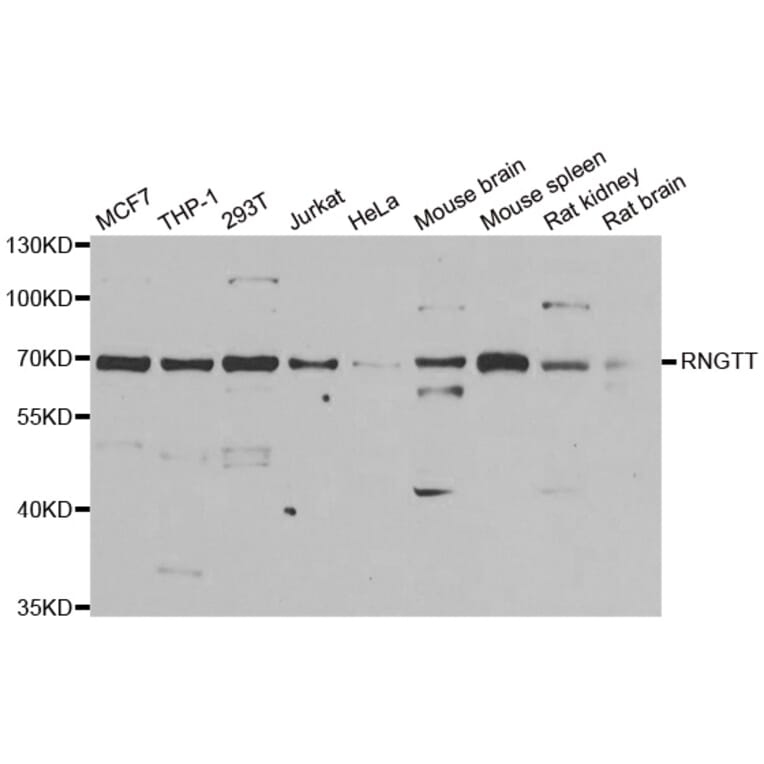 Western blot - RNGTT antibody from Signalway Antibody (38909) - Antibodies.com