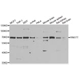 Western blot - RNGTT antibody from Signalway Antibody (38909) - Antibodies.com