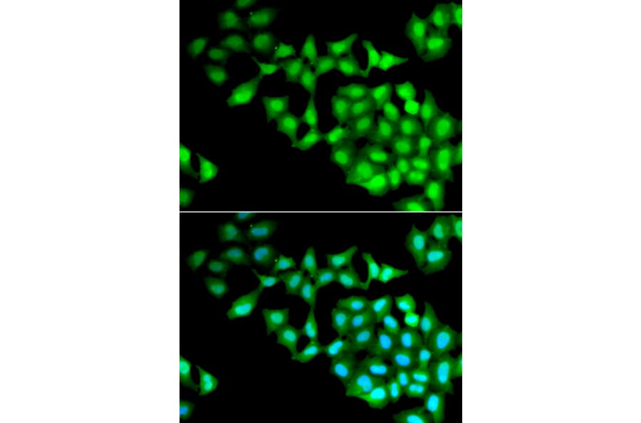 Immunofluorescence - RNGTT antibody from Signalway Antibody (38909) - Antibodies.com