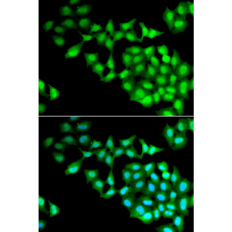 Immunofluorescence - RNGTT antibody from Signalway Antibody (38909) - Antibodies.com