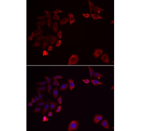 Immunofluorescence - SKAP2 antibody from Signalway Antibody (38913) - Antibodies.com