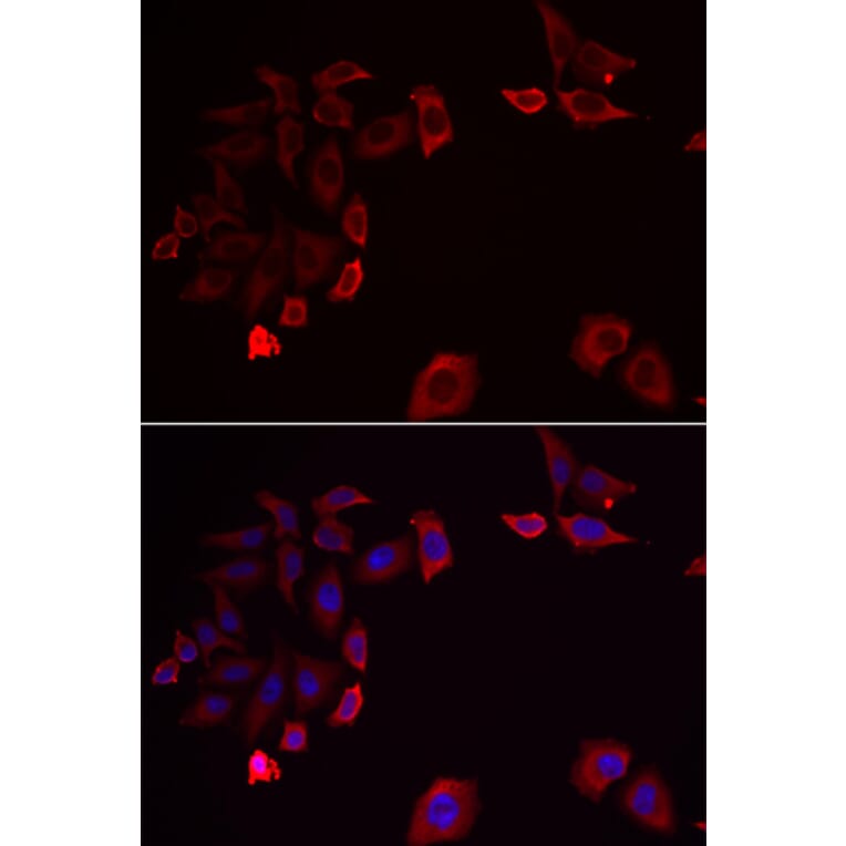 Immunofluorescence - SKAP2 antibody from Signalway Antibody (38913) - Antibodies.com