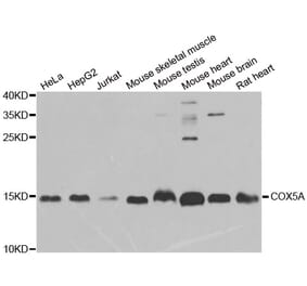 Western blot - COX5A antibody from Signalway Antibody (38915) - Antibodies.com