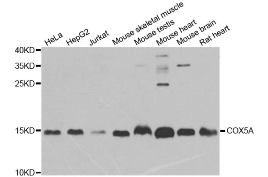 Western blot - COX5A antibody from Signalway Antibody (38915) - Antibodies.com