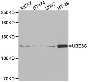 Western blot - UBE3C antibody from Signalway Antibody (38920) - Antibodies.com