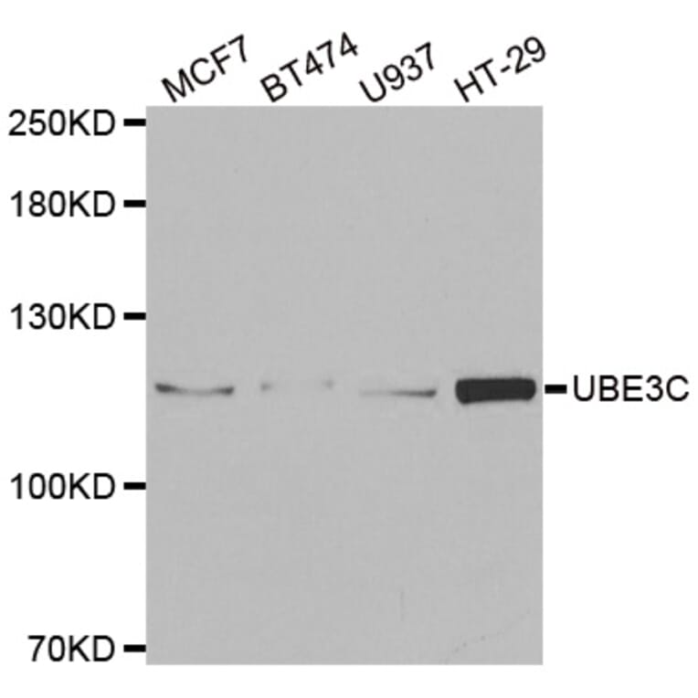 Western blot - UBE3C antibody from Signalway Antibody (38920) - Antibodies.com