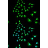Immunofluorescence - UBE3C antibody from Signalway Antibody (38920) - Antibodies.com