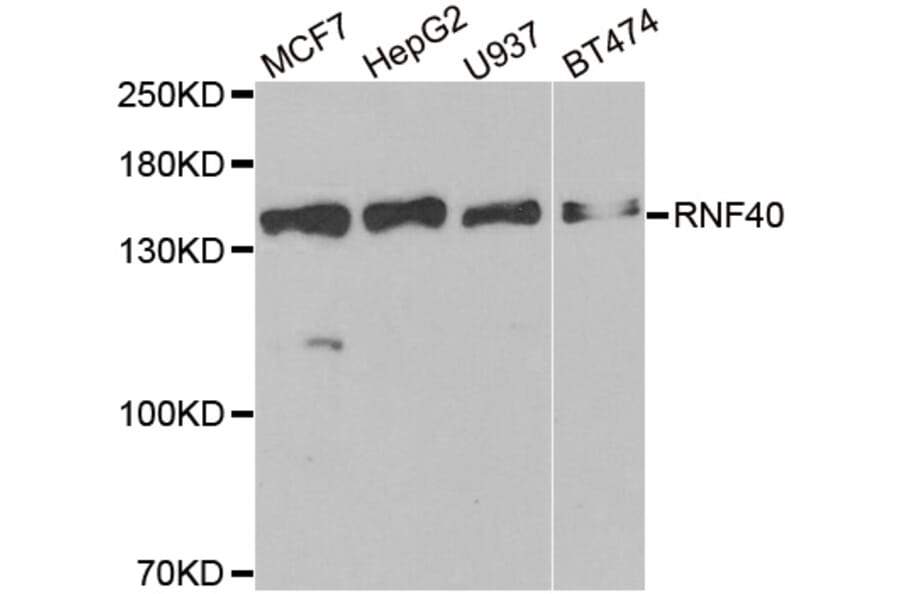 Western blot - RNF40 antibody from Signalway Antibody (38921) - Antibodies.com