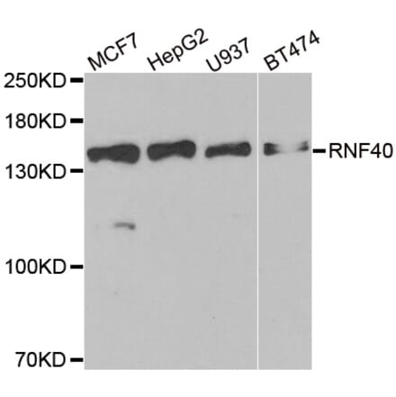 Western blot - RNF40 antibody from Signalway Antibody (38921) - Antibodies.com