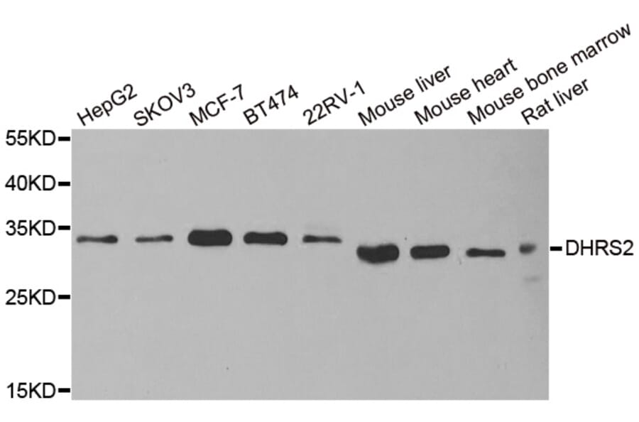 Western blot - DHRS2 antibody from Signalway Antibody (38924) - Antibodies.com