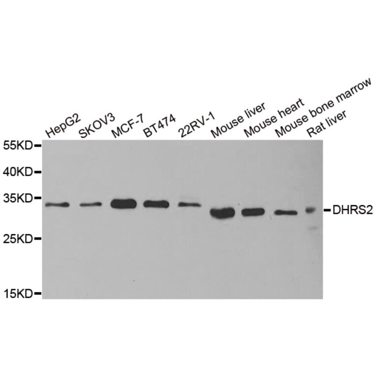 Western blot - DHRS2 antibody from Signalway Antibody (38924) - Antibodies.com